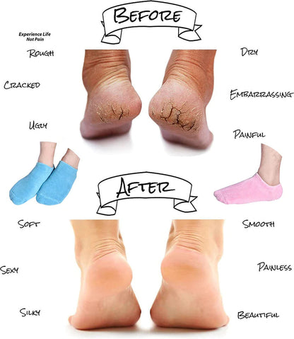 Foot Spa Pedicure Silicone Socks For Men & Women - Must for Winter Season